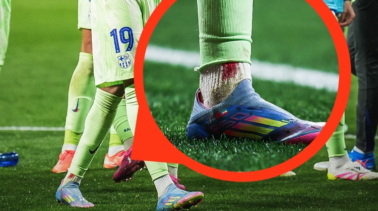 开云体育官网-亚马尔被朗格莱鞋钉刮到&amp;一瘸一拐很难受 赛后脚踝处血染球袜